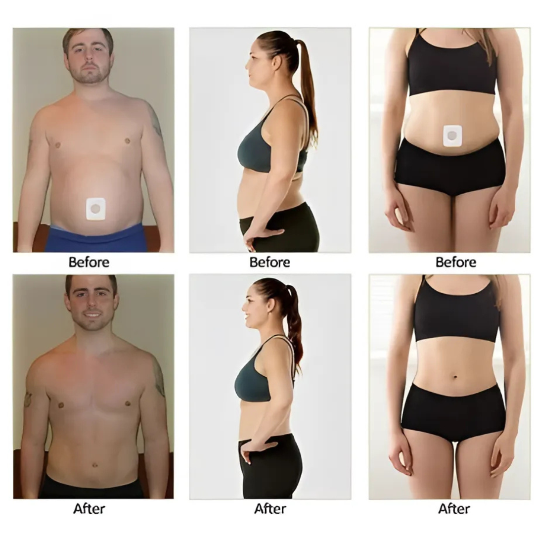 Slim Patch x 30™: Tu aliado diario para un abdomen ligero.