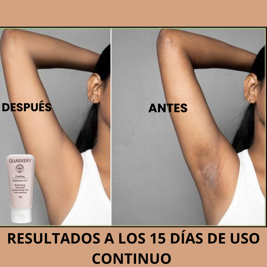 Exfoliante Quarxery™: Ideal para manchas y puntos negros.