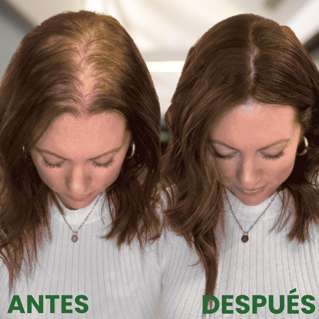 Oferta 2×1 Aceite de Batana Oil® + Obsequio premium 🎁