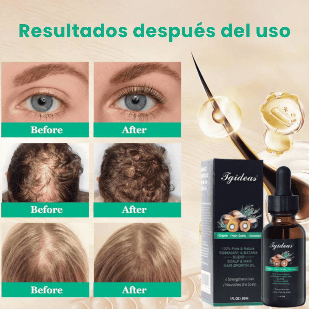Oferta 2x1 Aceite Batana Oil®: Reparador Capilar