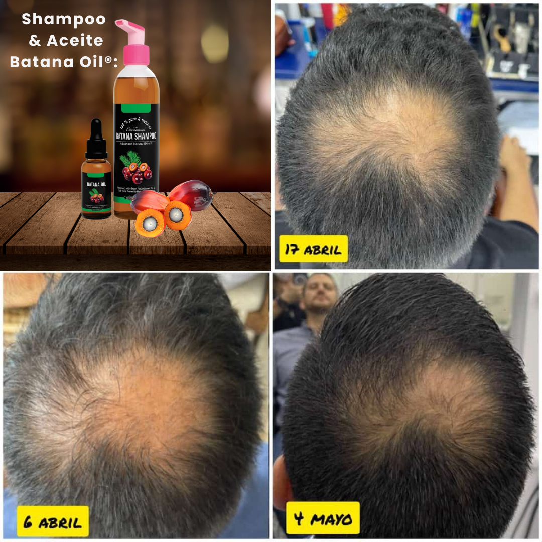 Dupla Poderosa®: Shampoo & Aceite de Batana Oil.