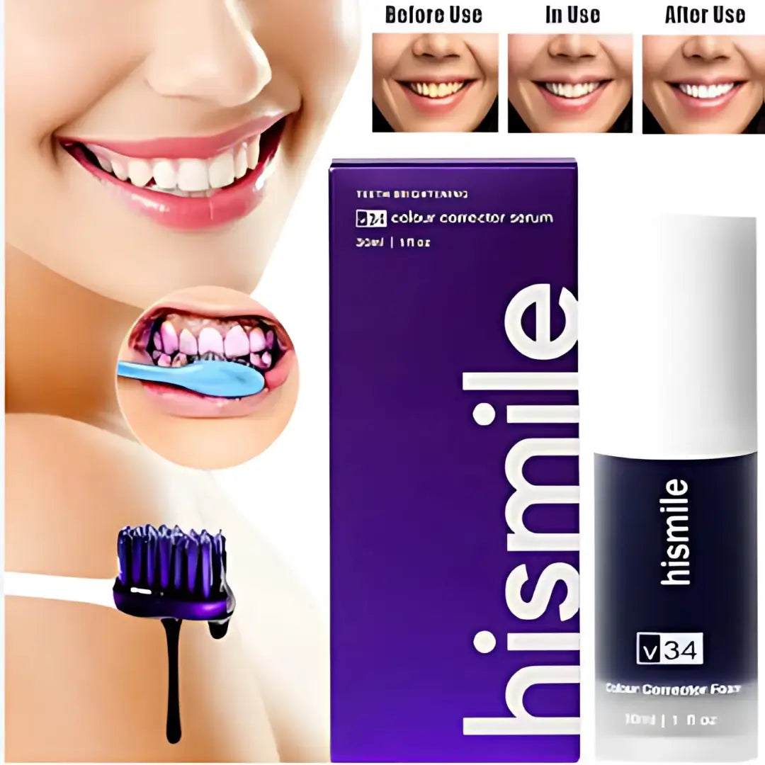 SmileEase®: Tu sonrisa, en su mejor versión!