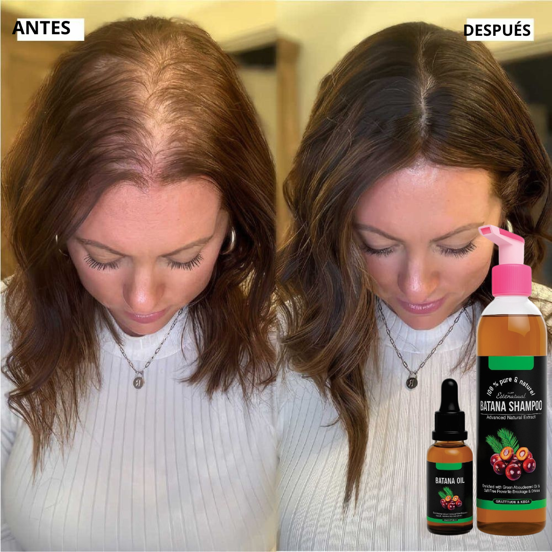 Dupla Poderosa®: Shampoo & Aceite de Batana Oil.
